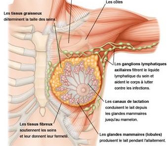 Le cancer du sein